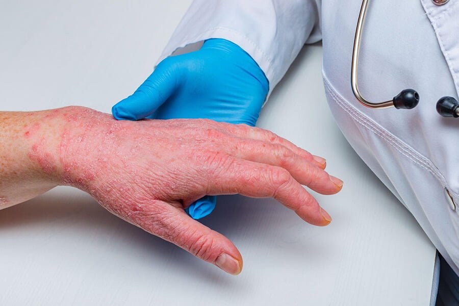 Interventi Dermatologici