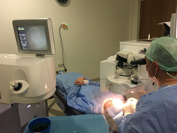Laser Occhi in Turchia